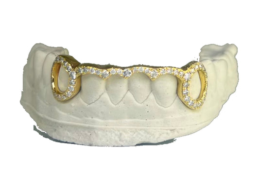 DIAMOND BAR